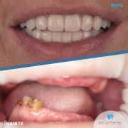 dp-ff-total-pacienta-52ani