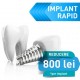 Promotie implant dentar rapid premium - 1000RON REDUCERE 