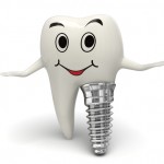 7 beneficii majore ale implantului dentar!