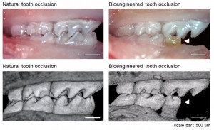 Bio-dintii, alternativa implantului dentar