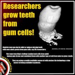  “Bio-dintii” obtinuti prin bioinginerie din celule stem, superiori implanturilor dentare?