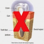 Contraindicatii implant dentar