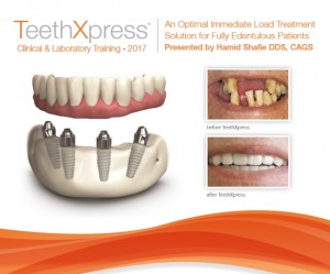 implanturi dentare all on 6 maxilar all on 4 mandibula