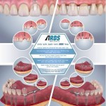 curs-protetica-implanturi-dentare-ards-mai-bucuresti-2015