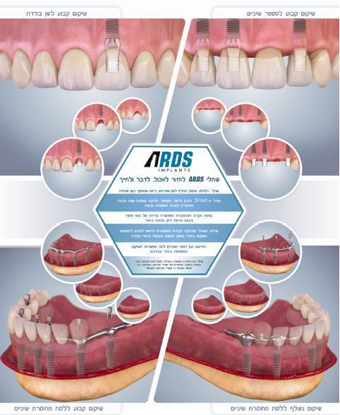 curs-protetica-implanturi-dentare-ards-mai-bucuresti-2015