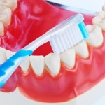 Igiena bucala dupa implanturi dentare: ingrijirea la domiciliu, instrumente utile, sfaturi