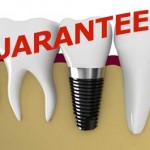 avantaje implant dentar durata de viata