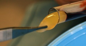 membrana a-prf stomatologie