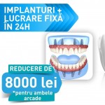 Ofertă Dinţi Ficşi în 24 ore cu implant dentar FastSmile INNO® – 8000RON reducere la restaurările dentare totale «INNOvator Fast Smile®» la maxilar şi/sau mandibulă