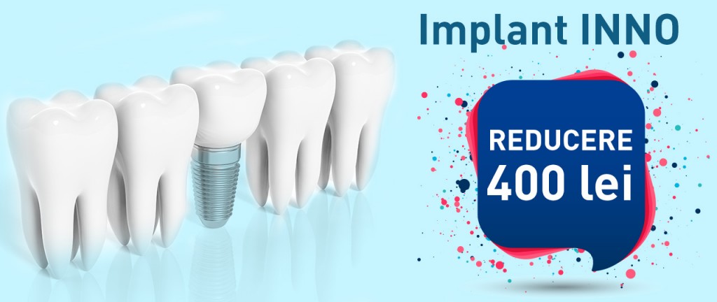 oferta reducere implant dentar ieftin