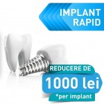Oferta implant dentar rapid INNO® – 1000RON reducere pana la 31 dec 2023