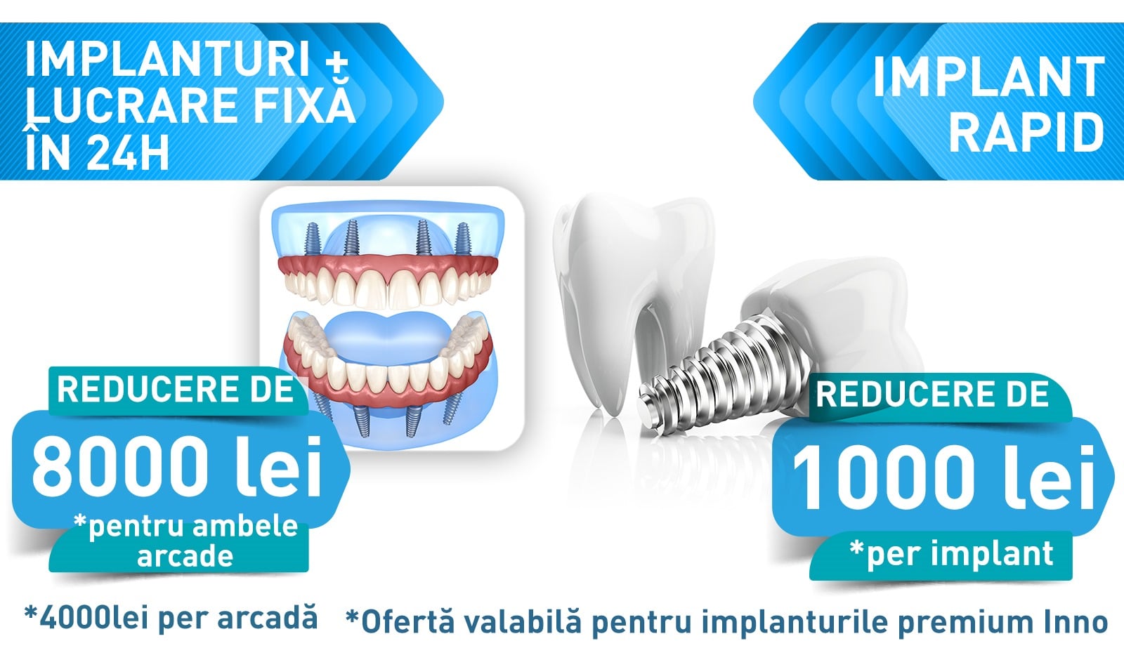 oferta reducere implant dentar ieftin
