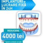 Ofertă implant dentar FastSmile INNO® – 4000RON reducere la restaurările dentare totale «INNOvator Fast Smile®» la maxilar şi/sau mandibulă