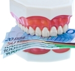 Lista preturi implanturi dentare rapide
