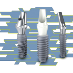 Implanturile dentare Anthogyr: caracteristici, beneficii, oferte preturi clinici