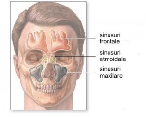 sinus maxilar lift aditie osoasa